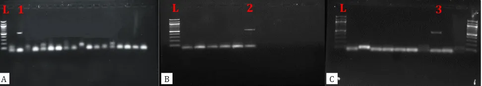 Figure 1. ATCCTTCGAAACAGGA-3' (R) and inner primers 5'-GGAAGGGTTGTATTTATTAGATAAAG - 3' (F), and 5'-AAGGAGTAAGGAA- A, B, C, show the results of nested second round PCR using outer primers 5'-TTCTAGAGCTAATACATGCG 3'(F), 5'CCCTA-CAACCTCCA-3' (R).Three positiv