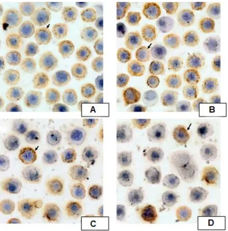 Figure 5. Correlations between percentages of maturation, apoptosis, and NF-correlations among the percentages of maturation (CD19+CD38+), apoptosis (Annexin V+PI+), and expressions of NF-B Cells