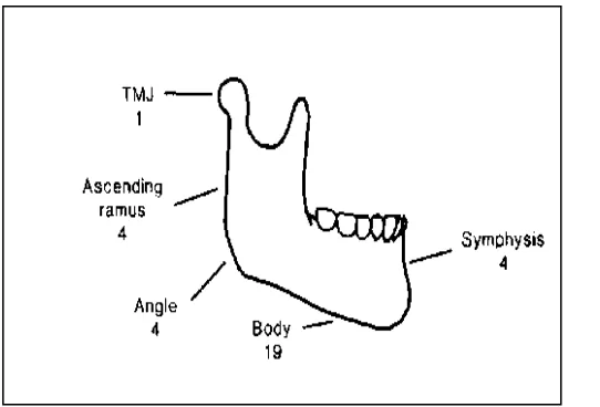 Gambar 1: Gambar anatomi maksila yang bisa terlibat osteosarcoma.9 