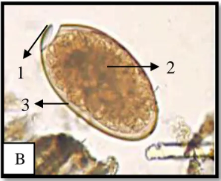 Gambar 4.2  Telur Fasciola sp. 