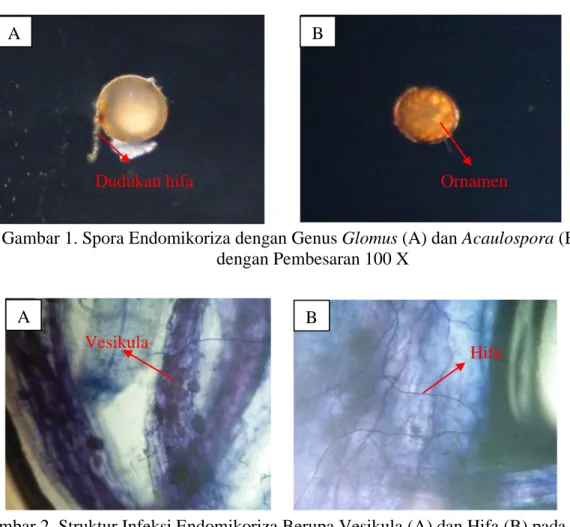 Gambar 2. Struktur Infeksi Endomikoriza Berupa Vesikula (A) dan Hifa (B) pada Akar  dengan Pembesaran 100 X 