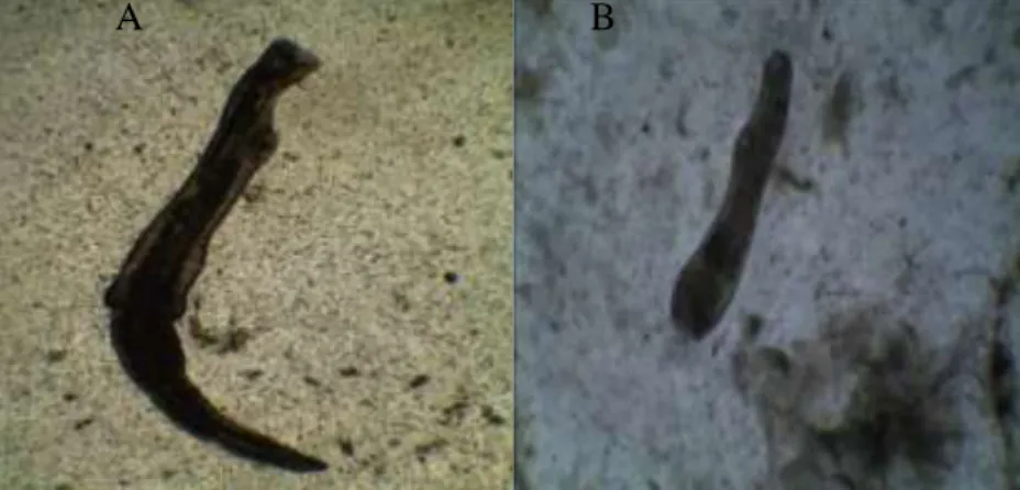 Gambar  1.  Cacing  parasitik  pada  saluran  pencernaan  ikan  selar  kuning  di  Karangantu  dan  Labuan  dengan  pembesaran  mikroskop  40x