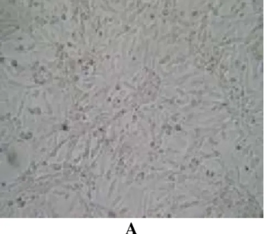 Gambar 2. Reaksi sel Vero terhadap supernatan E. coli.  