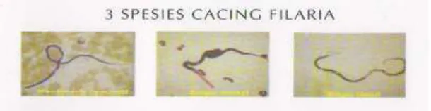 Gambar 2.3: Tiga Spesies Cacing Filaria 