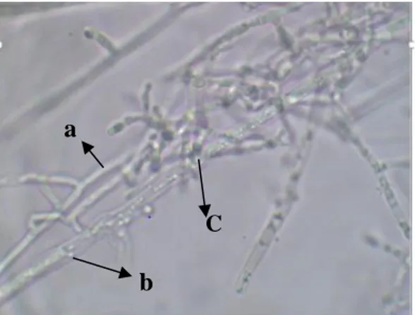 Gambar 4.  Mekanisme antagonisme mikoparasit Trichoderma sp.                      isolat JB terhadap jamur patogen S