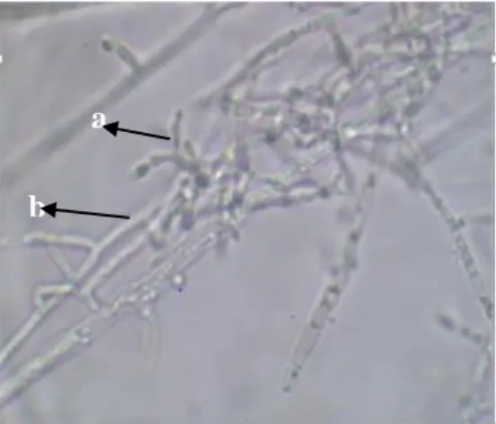 Gambar 4. Mekanisme antagonis mikoparasit Trichoderma sp. isolat JB  terhadap jamur akar putih (JAP) 