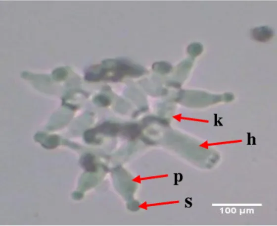 Gambar 2.  Struktur mikroskopis Trichoderma sp. isolat JB 