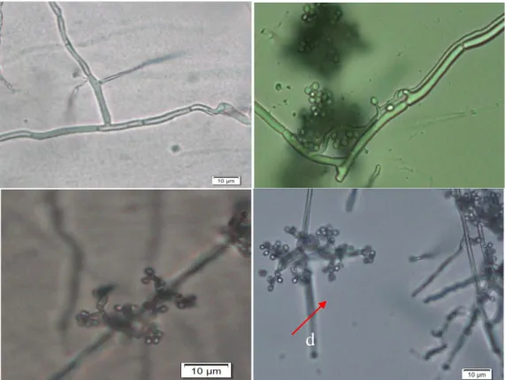 Gambar 1. Hasil foto mikroskopis a) hifa B. bassiana perbesaran 100x b) hifa B.  bassiana  perbesaran  100x  c)  konidia  B