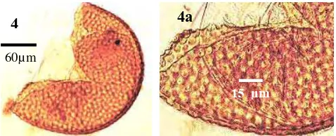 Gambar 4 Spora Acaulospora foveata, 4a perbesaran perhiasan  