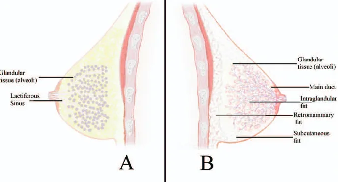 Figure 2. A, Traditional schematic diagram of the anatomy of the breast. The main milk ducts below the nipple are depicted as dilated portions or lactiferoussinuses, and the glandular tissue is deeper within the breast