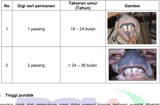 Tabel 3  ─ Penentuan umur berdasarkan susunan gigi seri permanen 