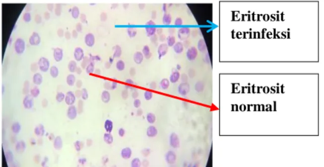 Gambar 1 Pengamatan mikroskopik sel darah merah                     pada mencit terinfeksi Plasmodium berghei