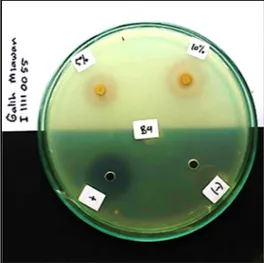 Gambar 1. Hasil uji aktivitas antibakteri masa inkubasi 24 jam