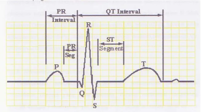 Gambar 1. EKG normal.  Dikutip dari : Mirvis D.M, Goldberger A.L  2005. Electrocardiography