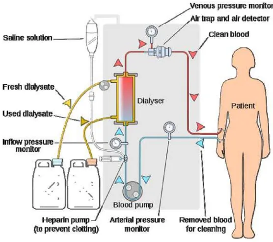 Gambar 2. Proses hemodialisis 