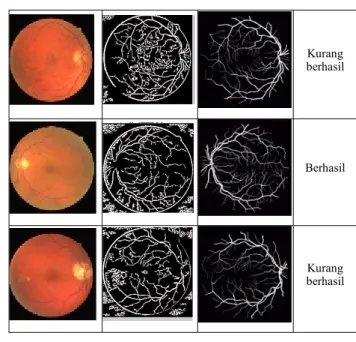 TABEL 1.        PENGOLAHAN DATA STARE  G.Asli  Hasil olah  G. truth/acuan  Ket. 