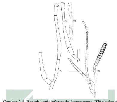 Gambar 2.4. Bentuk konidiofor pada Ascomycota (Thielaviopsis basicola).  Keterangan: a