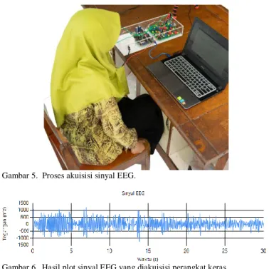 Gambar 5.  Proses akuisisi sinyal EEG. 