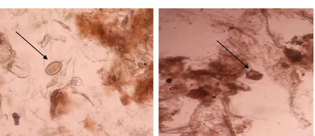 Gambar 1. Hasil pemeriksaan mikroskop ditemukan telur cacing Ascaridia galli 