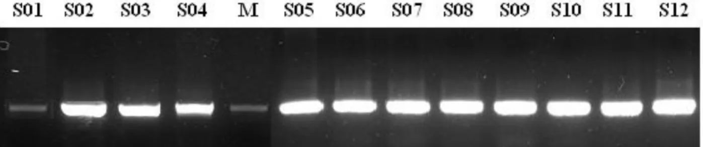 Gambar 1.  Elektroforesis DNA total hasil isolasi menggunakan Genomik DNAPurification Kit dari  Promega
