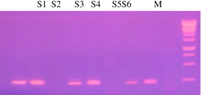 Gambar 2.  Elektroforesis produk PCR-RFLP gen reseptor hormon pertumbuhan menggunakan       primer GHR 1