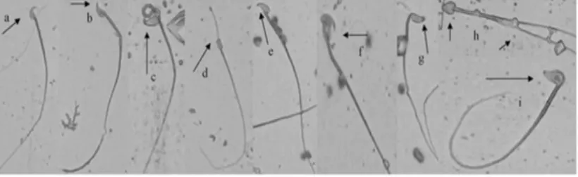 Gambar 2.2 Morfologi spermatozoa mencit. (a) spermatozoa normal, (b) pengait  salah membengkok, (c) sperma melipat, (d) kepala terjepit, (e) pengait pendek, (f) kesalahan ekor sebagai alat tambahan, (g) tidak ada penggait, (h) sperma berekor ganda dengan k