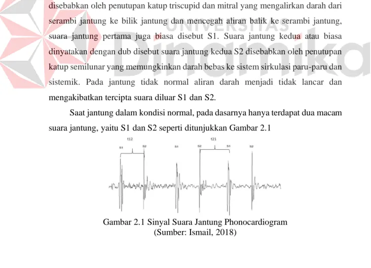 Gambar 2.1 Sinyal Suara Jantung Phonocardiogram  (Sumber: Ismail, 2018)  