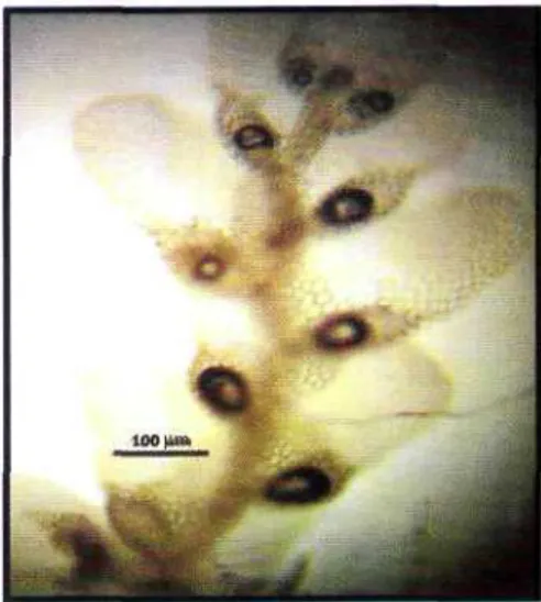 Foto 2. Cheilolejunea ceylanica, foto: I. Haerida, no koleksi IH 815.