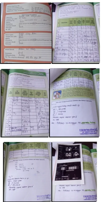 Foto Buku KIA klien