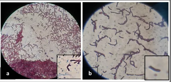 Gambar  5.  Morfologi  sel  baktei  uji  yang  berasal  dari  Balai  Penelitian  dan  Pengembangan Budidaya Air Payau:  5a)
