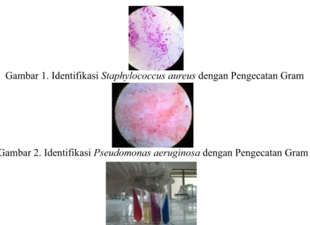 Gambar 1. Identifikasi Staphylococcus aureus dengan Pengecatan Gram