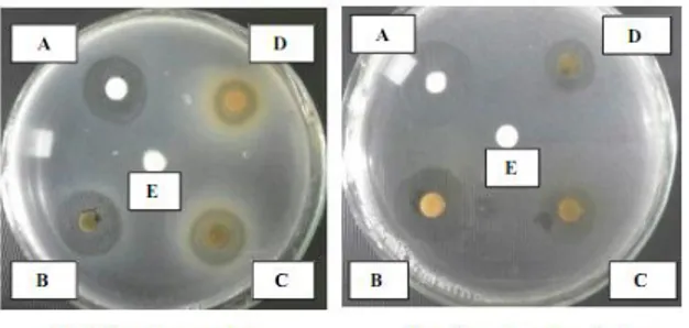 Gambar  2.  Foto  hasil  uji  daya  hambat  ekstrak  etanol  daun  beluntas  terhadap  bakteri 