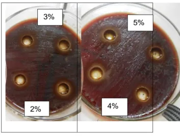 Gambar  4.1  Hasil  Uji  Aktivitas  Antibakteri  ekstrak  daun  beluntas  terhadap Propionibacterium acnes  Dari  hasil  tersebut  dapat  diukur  diameter  yang  dibentuk