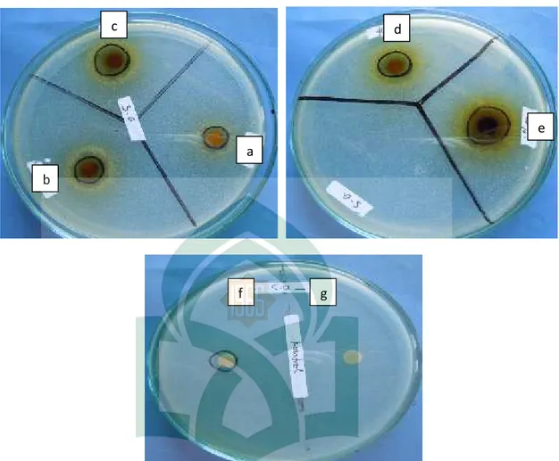 Gambar  4. Foto pengujian daya hambat ekstrak etanol daun ubi jalar ungu  (Ipomoea batatas Var Ayamurasaki) terhadap bakteri Staphylococcus aureus