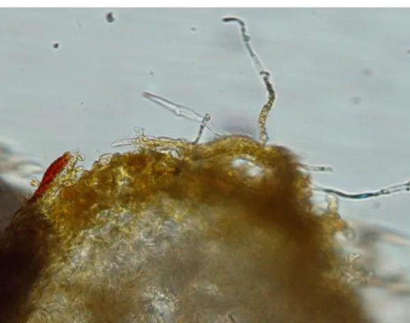 Gambar 6. Irisan melintang akar tanaman yang terinfeksi ektomikoriza  