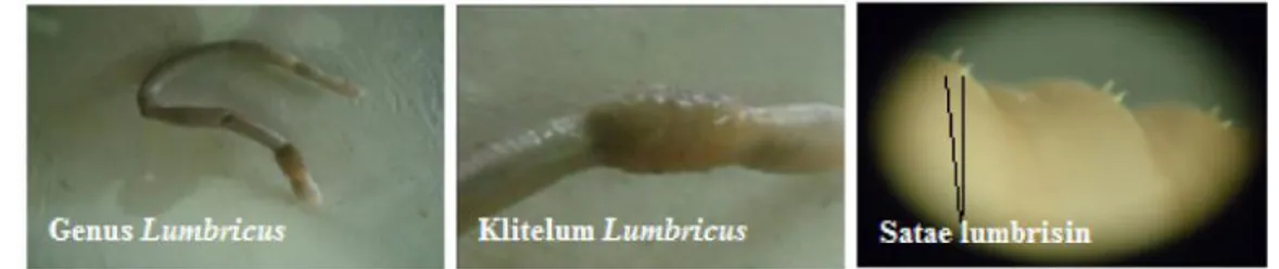 Gambar 1. Hasil identifikasi cacing tanah pada lahan pertanaman tebu, klitelum Lumbricus dan setae lumbrisin