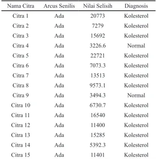 Tabel 4. Hasil pegujian dengan nilai threshold 100 Nama Citra Arcus Senilis Nilai Selisih Diagnosis