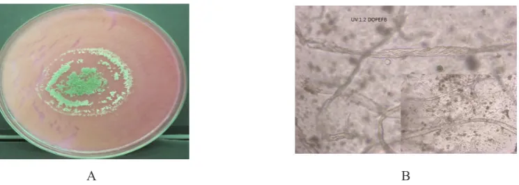 Figure 4. A. Colony Growth Profile of Mutant UV-1.2 on The Mandels Agar Containing 200 Mesh DOPEFB Powder B