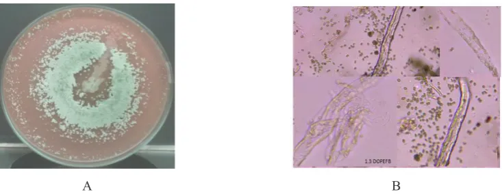 Figure 5. A. Colony Growth Profile of Mutant 1-3 on The Mandels Agar Containing 200 Mesh 