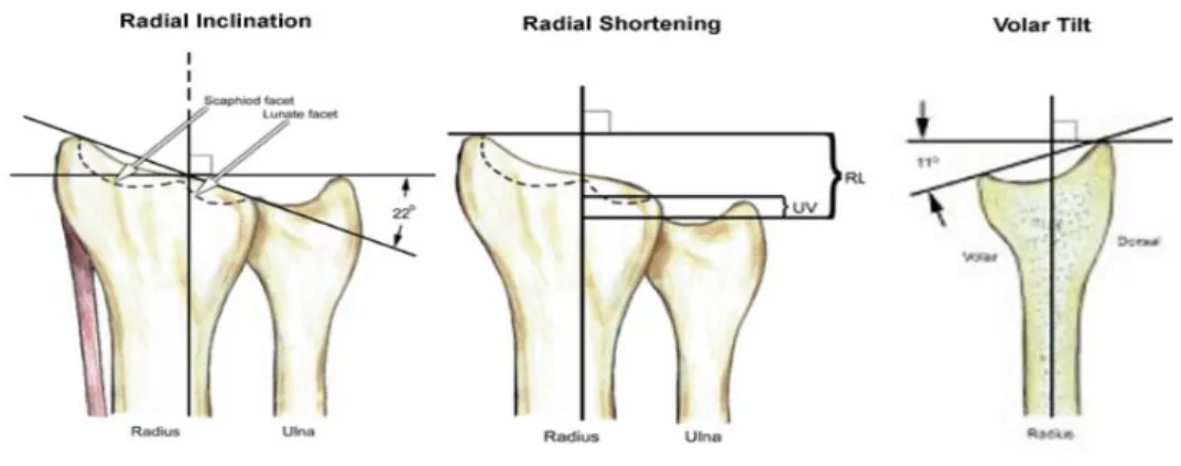 Gambar 2. Penilaian radiologi normal distal radius. 10