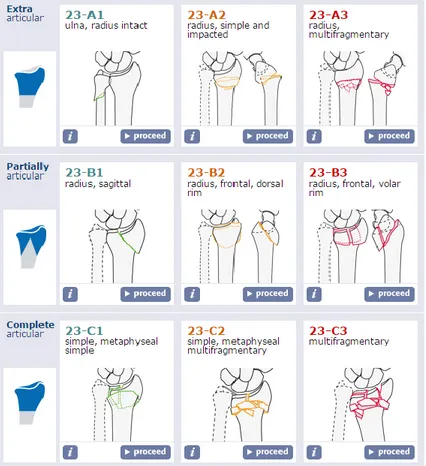 Gambar 5. Klasifikasi distal radius berdasarkan AO 