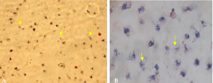 Gambar 4A Netrofil tanpa pa pemaparan bakteri P.gingivalisB pembesaran A 400x, da, dan B 1000x