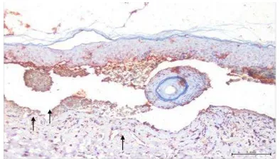 Gambar 3.Distribusi ekspresi IgG pada berbagai blister subepidermal. 