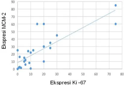 Gambar 3. A. Ekspresi KI-67 dengan LI rendah pada astrositoma derajat II dan B. Ekspresi Ki-67 dengan LI tinggi pada glioblastoma (astrositoma derajat IV) 