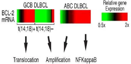 Gambar 2. Mekanisme ekspresi Bcl-2. Pada diffuse large B-cell lymphoma subtipe GCB ekspresi Bcl-2 terjadi melalui translokasi dan amplifikasi gen, se-dangkan pada subtipe non-GCB (ABC) terjadi melalui amplifikasi gen dan aktivasi jalur NfkB