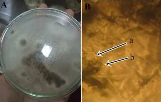 Gambar 7 (A) Koloni Penicellium sp2. setelah berumur 7 hari pada media PDA dan (B) Bentuk miksoskopik, (a) Konidia, (b)Konodiofor 