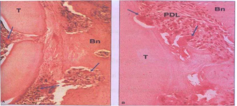 gambar 2 dan 3. 7,21,22 
