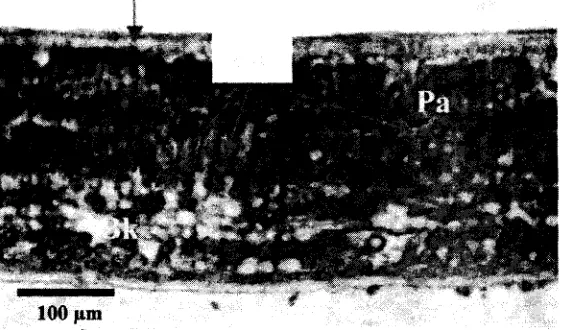 Gambar 14. Akumulasi timbel pada daun angsana Pa : palisade, Bk : Bunga karang Tanda anak panah menunjukkan lokasi terakumulasinya partikel timbel 