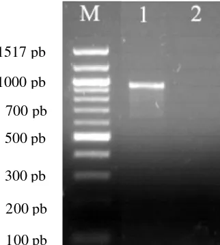 Gambar 1. DBL3x gen var2csa hasil amplifikasi PCR. M: 100 pb DNA Ladder sebagai pita