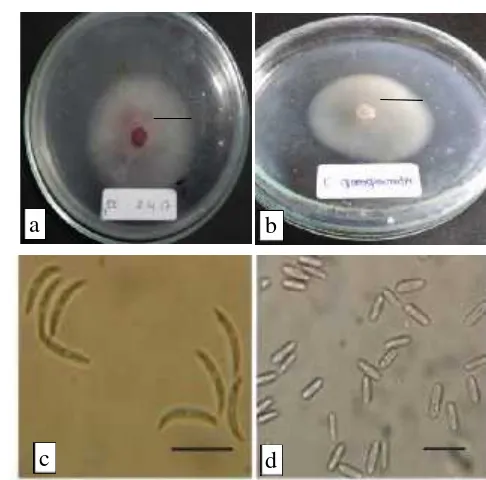 Gambar 1. Hasil pengamatan C. capsici dan C. gloeospoiroides (perbesaran 400x). a.C. capsicipada medium PDA umur 4 hari; b
